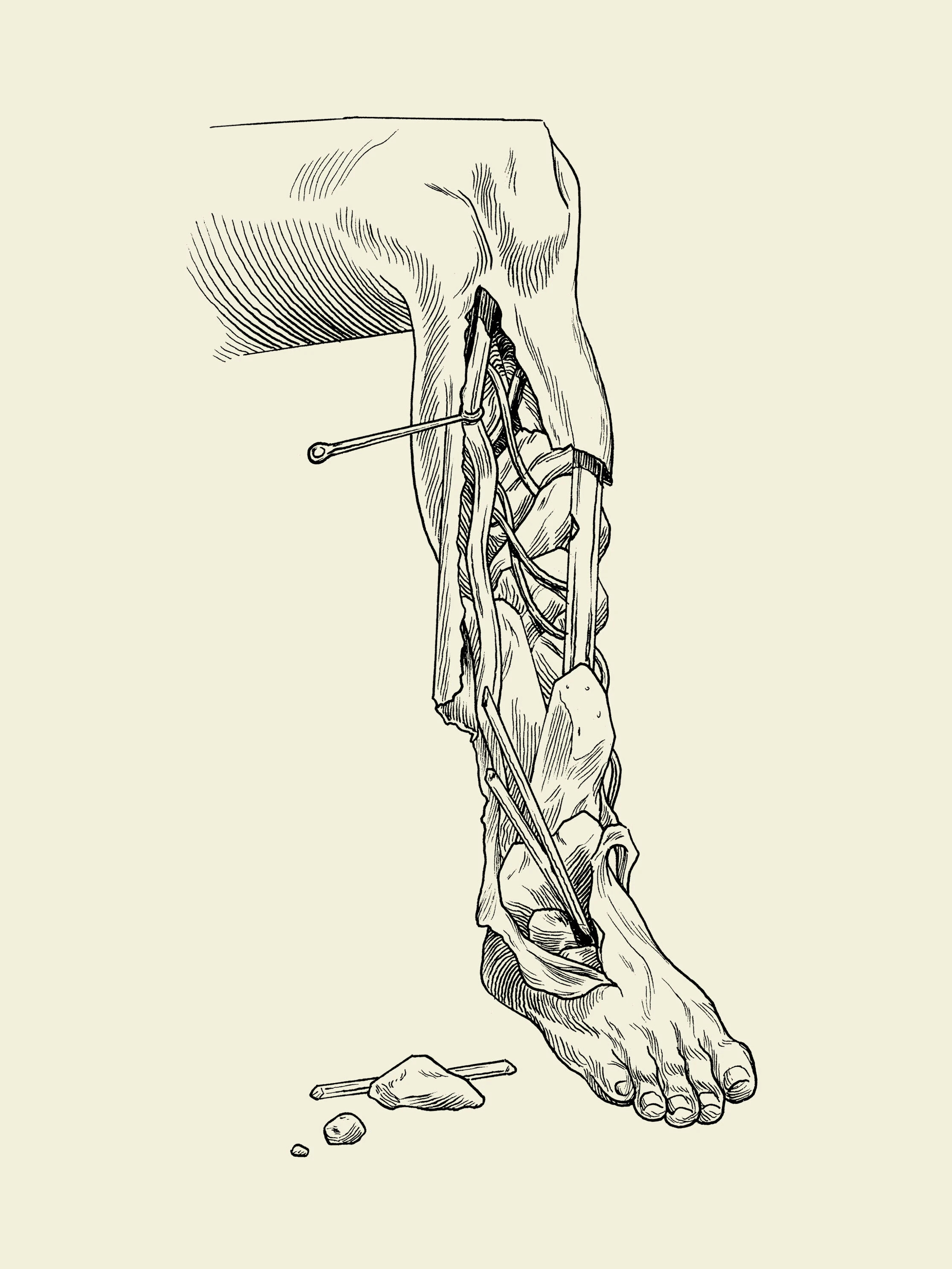 Drawing of a leg.